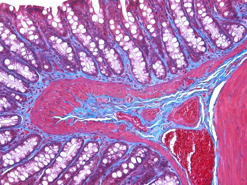 Digital Pathology Histology Slides for Cancer Modeling